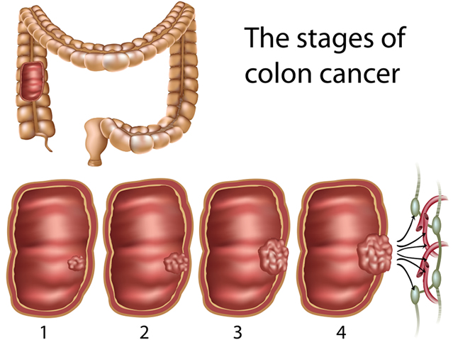 Colon Anatomy